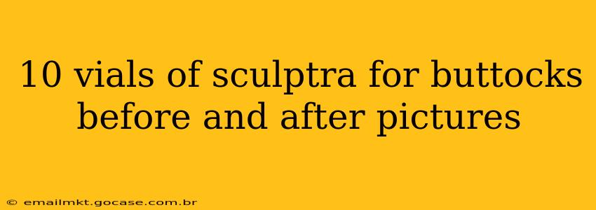 10 vials of sculptra for buttocks before and after pictures