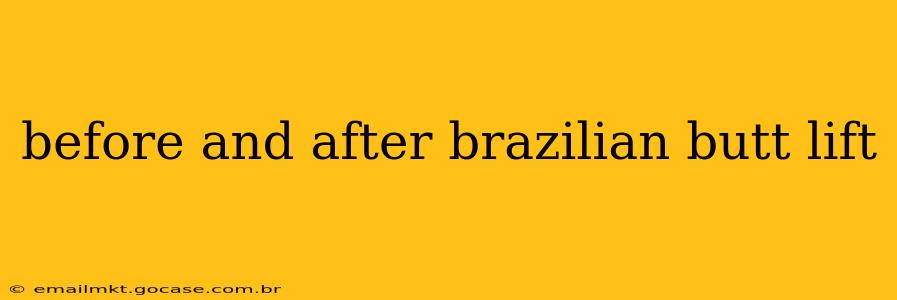 before and after brazilian butt lift
