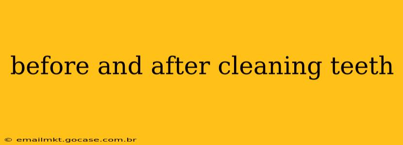 before and after cleaning teeth