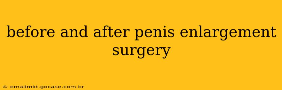 before and after penis enlargement surgery