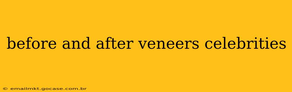 before and after veneers celebrities