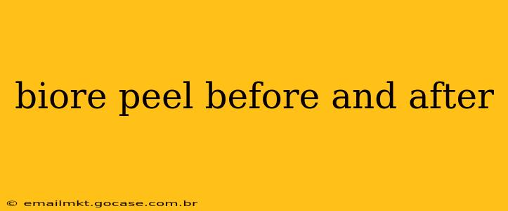 biore peel before and after