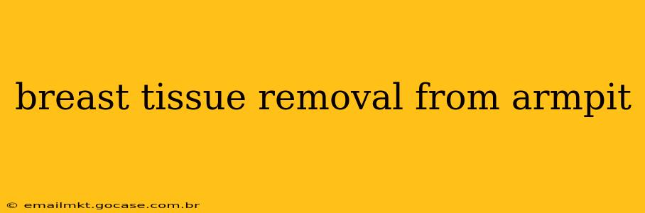 breast tissue removal from armpit