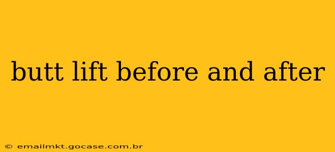 butt lift before and after