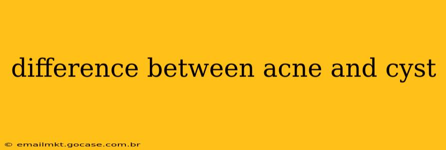 difference between acne and cyst