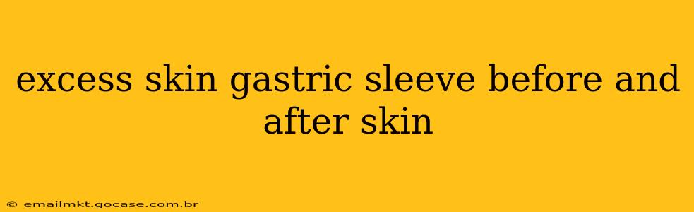 excess skin gastric sleeve before and after skin