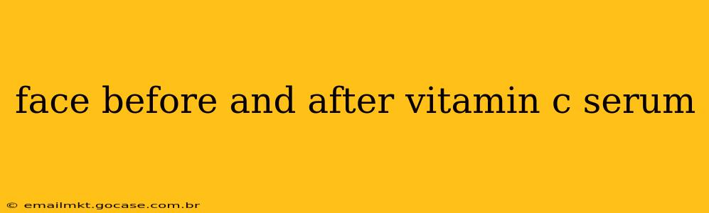 face before and after vitamin c serum