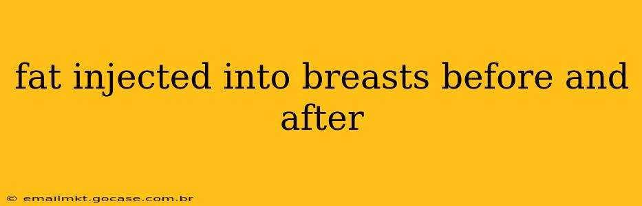 fat injected into breasts before and after
