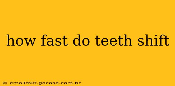 how fast do teeth shift