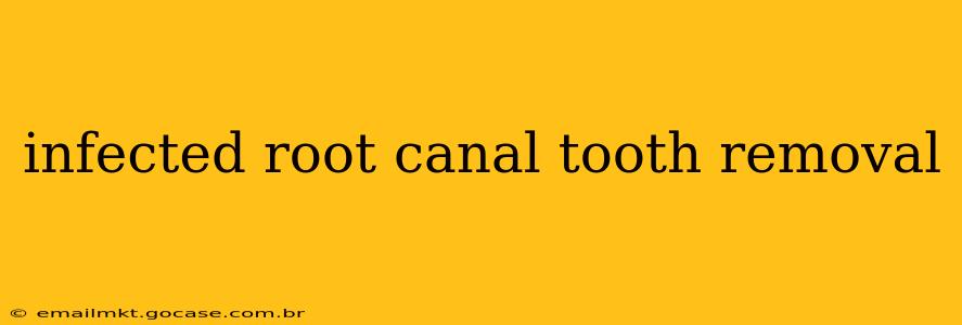 infected root canal tooth removal