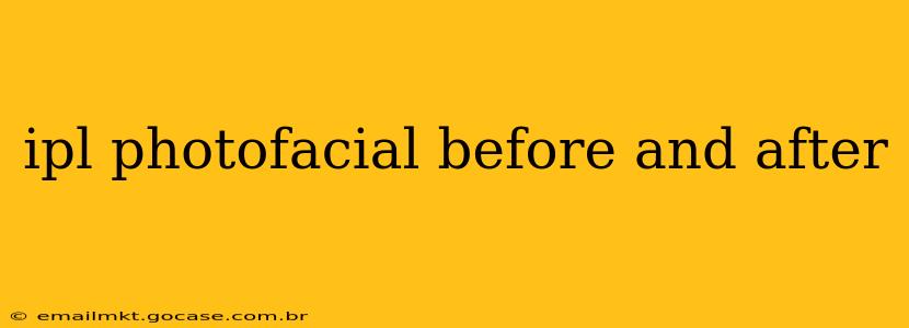 ipl photofacial before and after