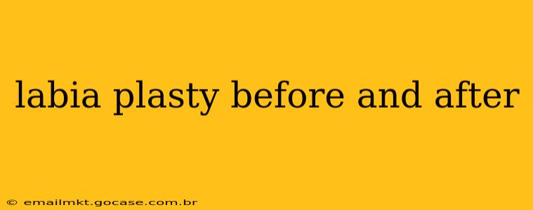 labia plasty before and after