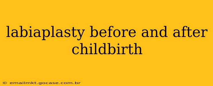 labiaplasty before and after childbirth