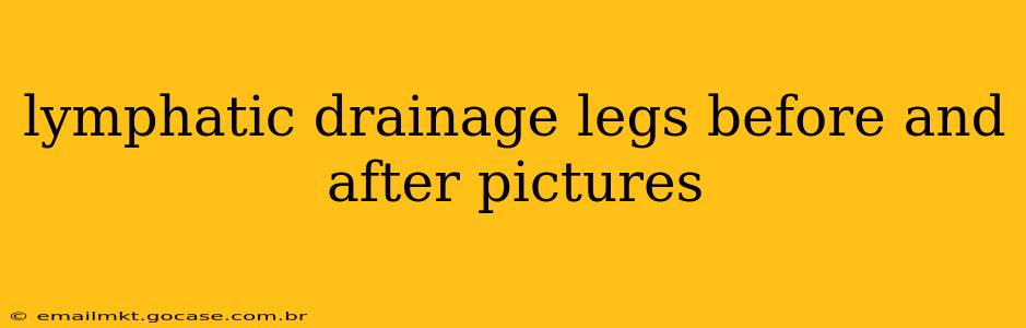 lymphatic drainage legs before and after pictures