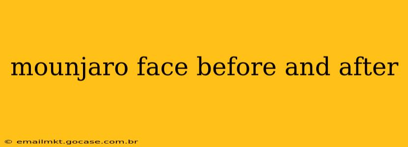 mounjaro face before and after