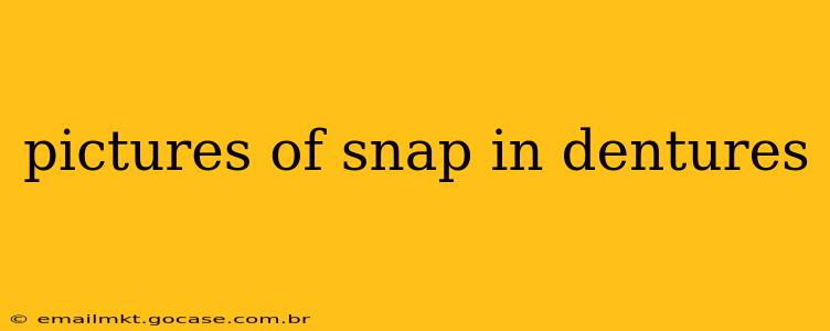 pictures of snap in dentures