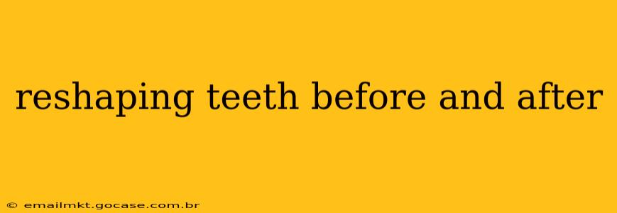 reshaping teeth before and after