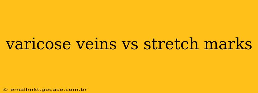 varicose veins vs stretch marks