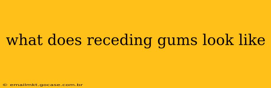 what does receding gums look like