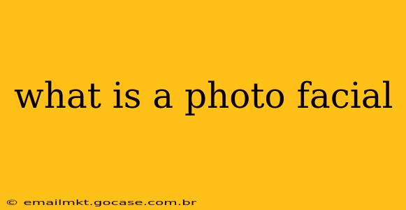 what is a photo facial
